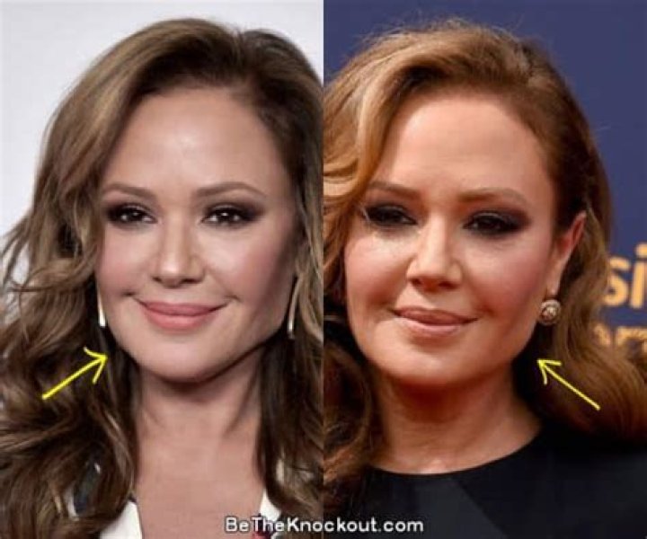 Did Leah Remini Get Botox? Here Is The Fact About Nose Job And Beauty Secret Of Actress